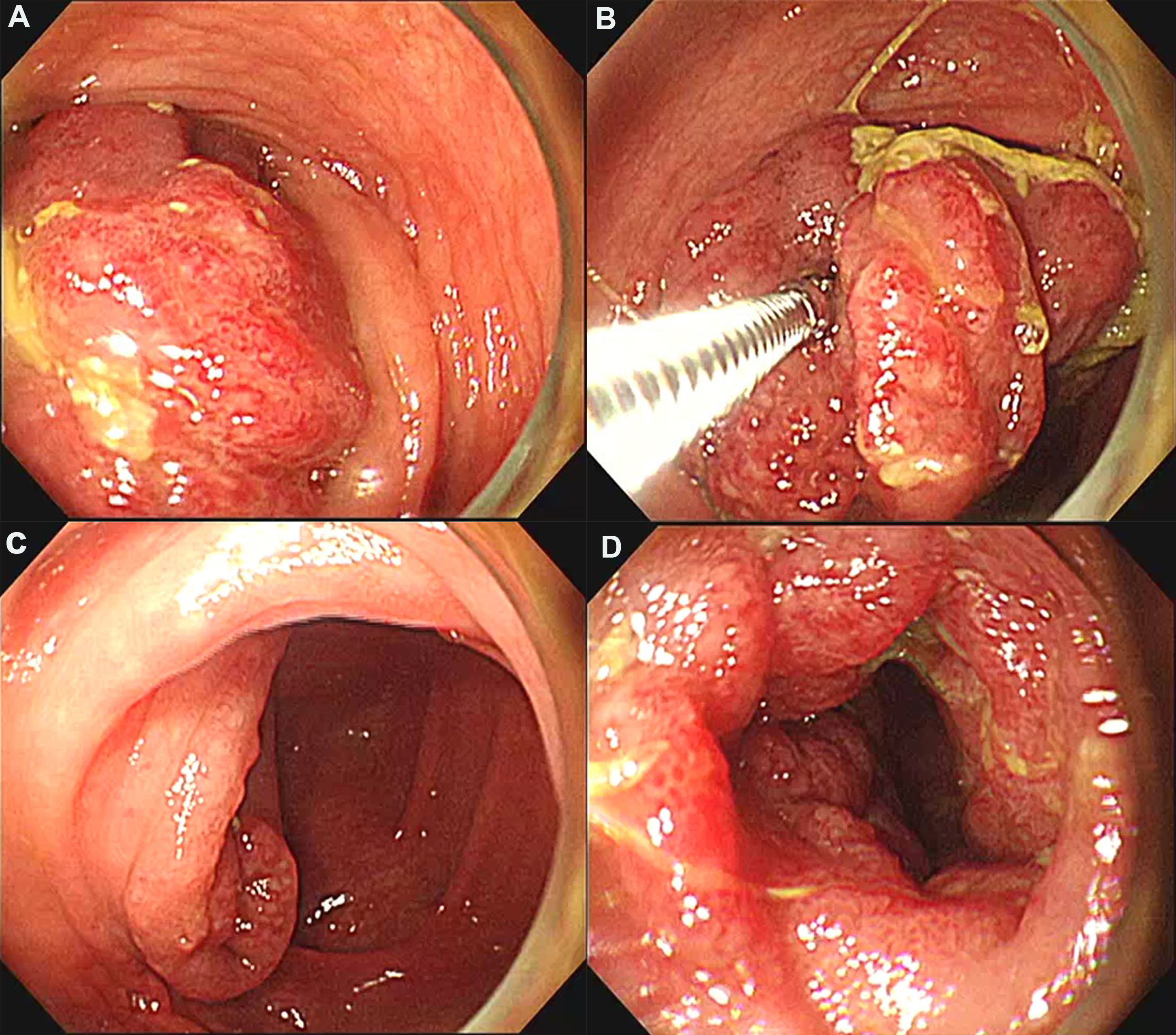Figure 4