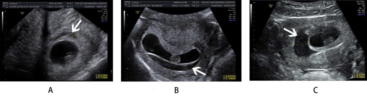 A retrospective study of pregnancy outcomes when intravenous